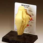 Knee Model from Anatomical Charts
